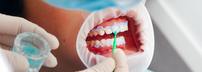 is cosmetic dentistry covered by insurance