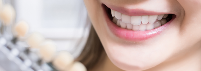 do's and dont's of teeth whitening