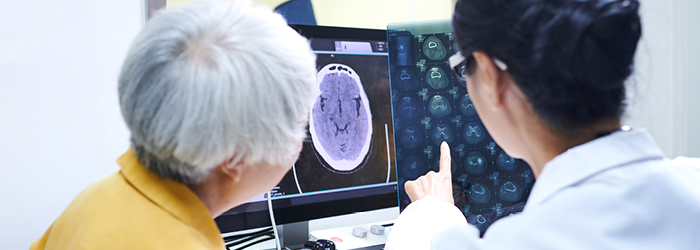 Link between Alzheimers and Gum Disease