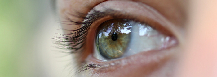 What are eye floaters