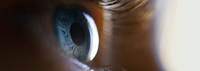 What are eye floaters