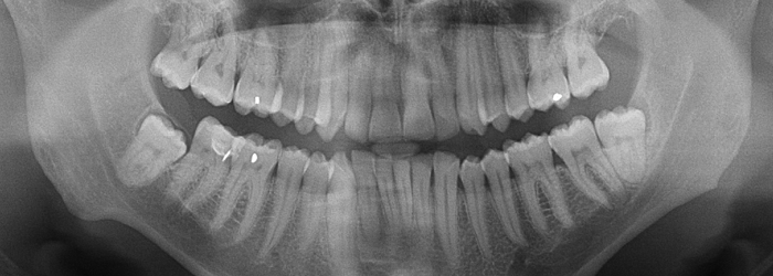 Future of dentistry